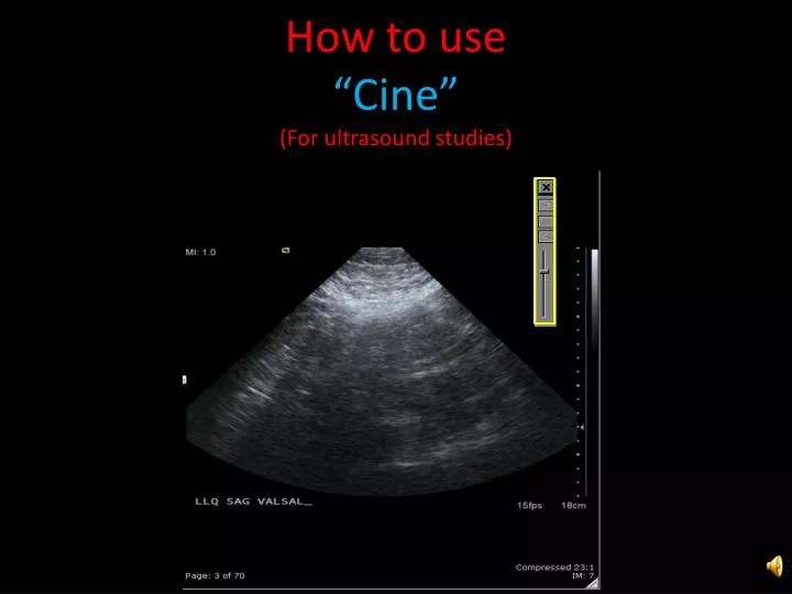 how to use cine for ultrasound studies