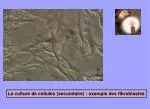 La culture de cellules (secondaire) : exemple des fibroblastes - slide 1