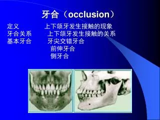 occlusion
