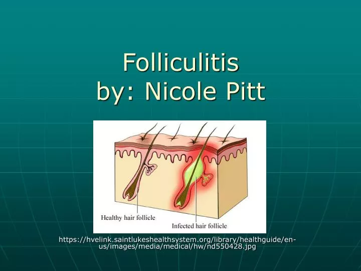 folliculitis by nicole pitt