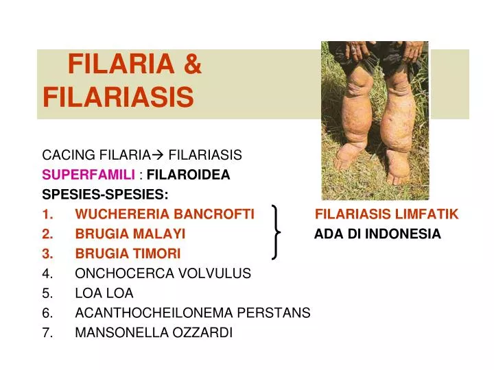 filaria filariasis