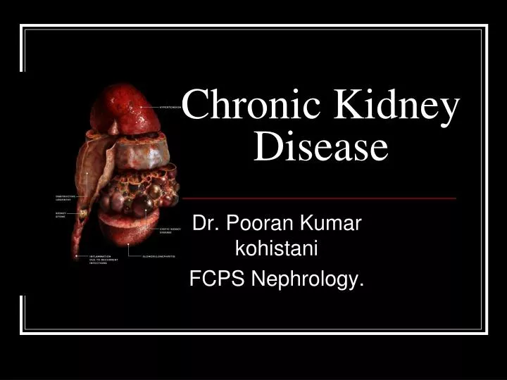 Ppt Chronic Kidney Disease Powerpoint Presentation Free Download
