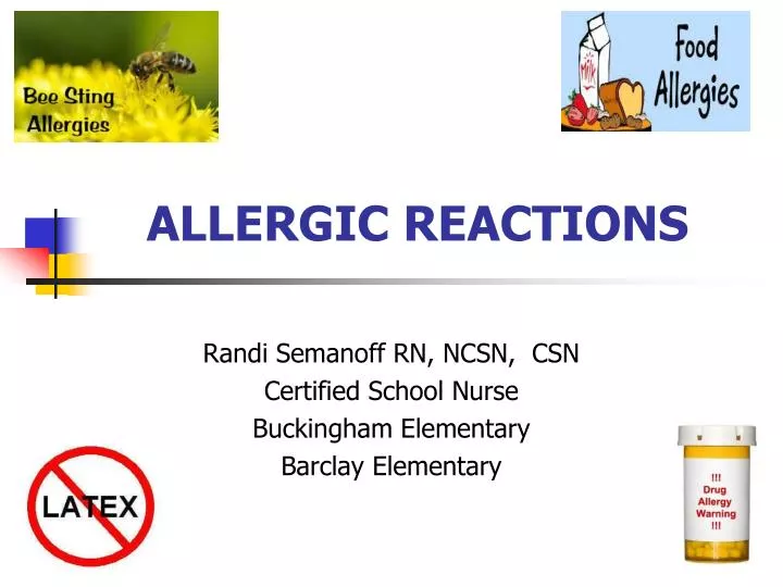 allergic reactions