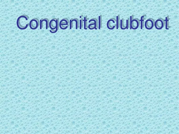 congenital clubfoot