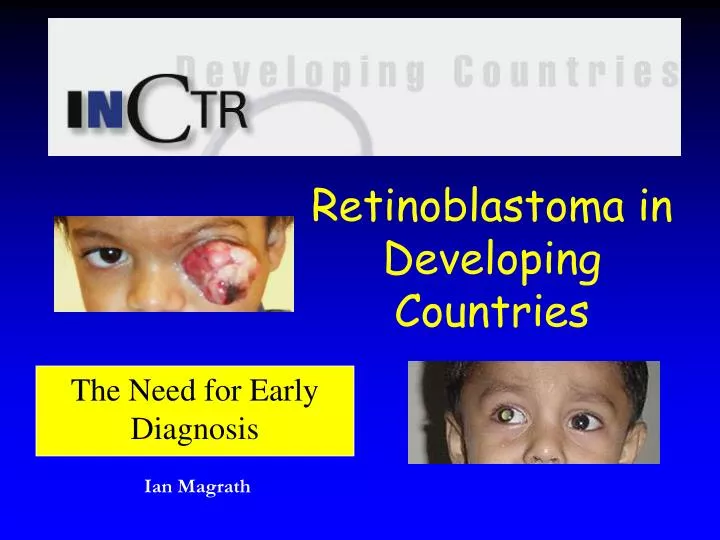 retinoblastoma in developing countries