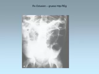 rx oclusion grueso http reg