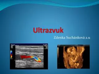 ultrazvuk