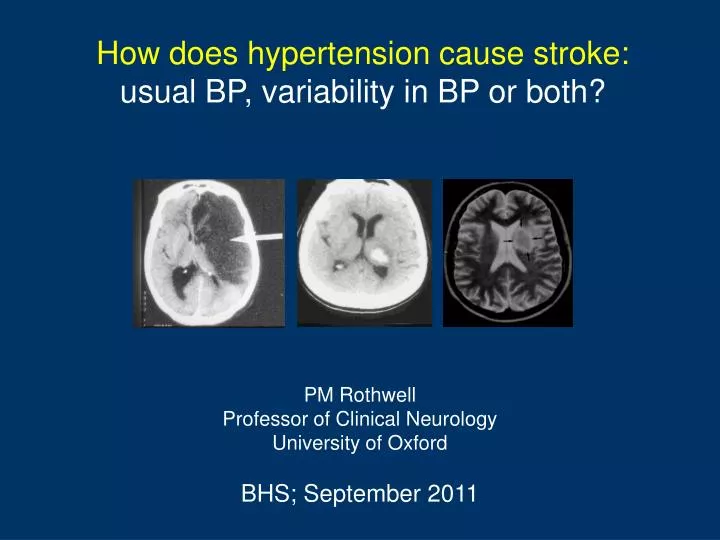 how does hypertension cause stroke usual bp variability in bp or both