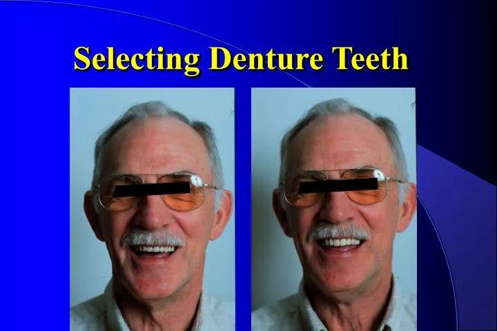 selecting denture teeth