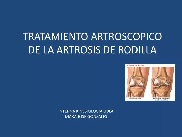 tratamiento artroscopico de la artrosis de rodilla