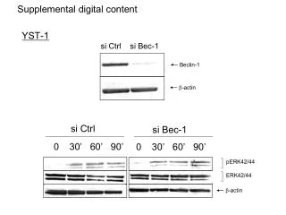 Beclin-1