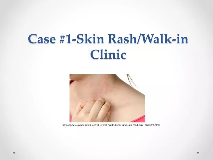 case 1 skin rash walk in clinic