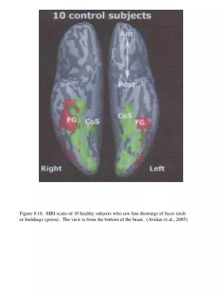 Figure 8.16. MRI scans of 10 healthy subjects who saw line draw