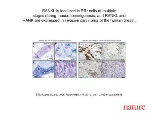 E Gonzalez-Suarez et al. Nature 000 , 1-5 (2010) doi:10.1038/nature09495