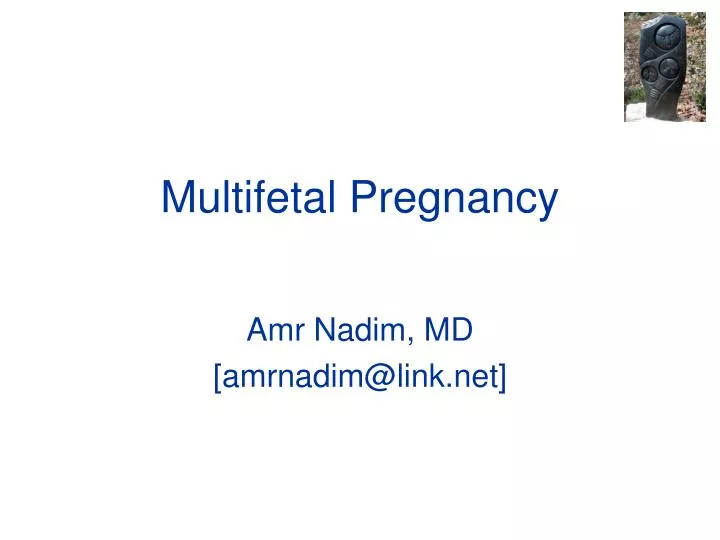 PPT - Multifetal Pregnancy PowerPoint Presentation, Free Download - ID ...