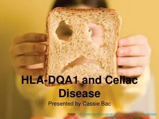 HLA-DQA1 and Celiac Disease