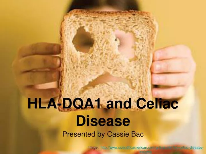 hla dqa1 and celiac disease