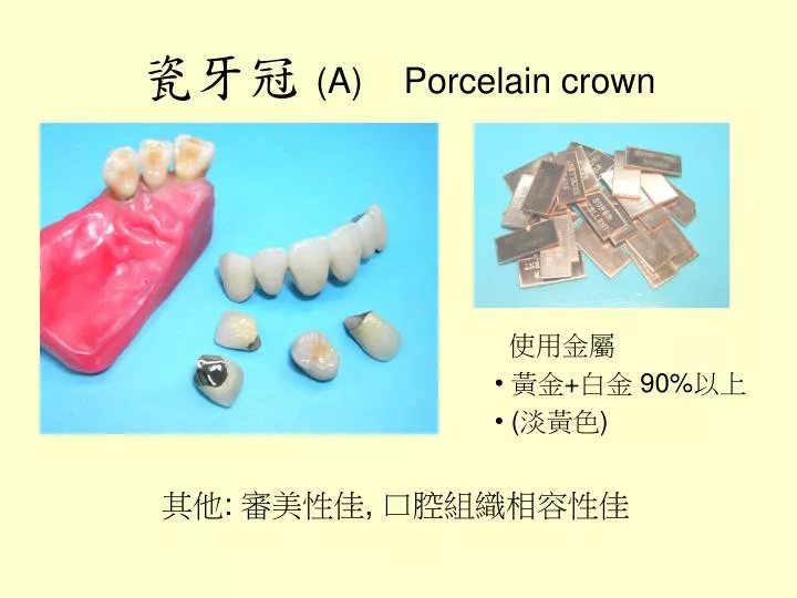 a porcelain crown
