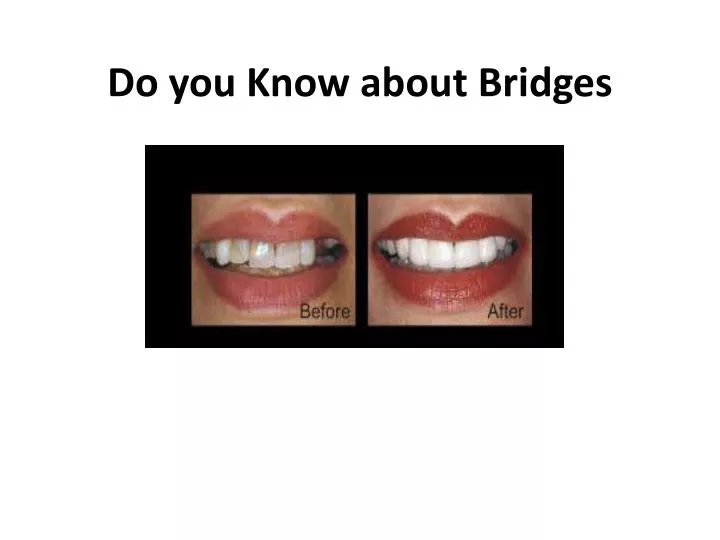 do you know about bridges