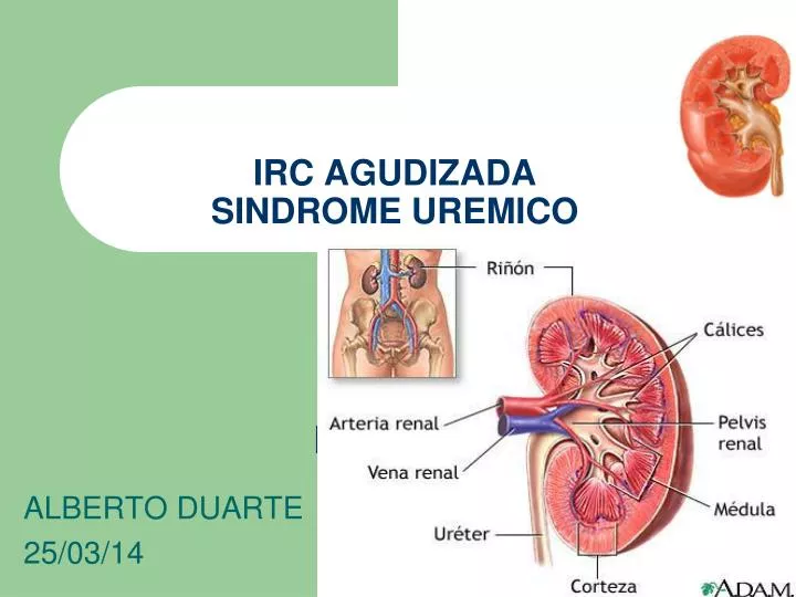 irc agudizada sindrome uremico