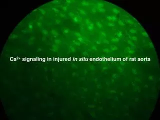 Ca 2+ signaling in injured in situ endothelium of rat aorta