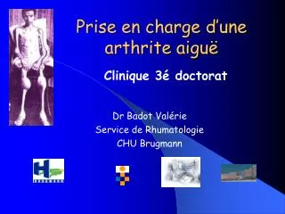 prise en charge d une arthrite aigu