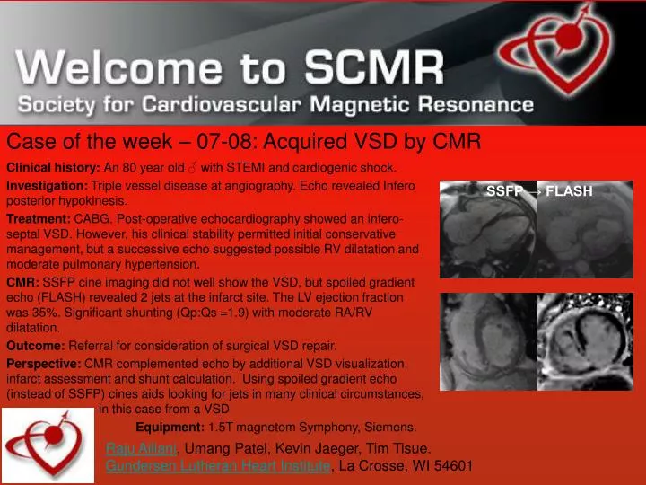 case of the week 07 08 acquired vsd by cmr