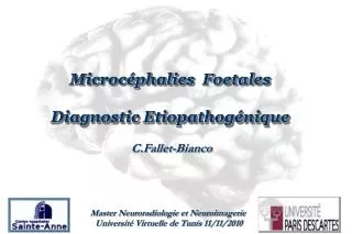 Microcéphalies Foetales Diagnostic Etiopathogénique