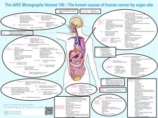 The IARC Monographs Volume 100 : The known causes of human cancer by organ site