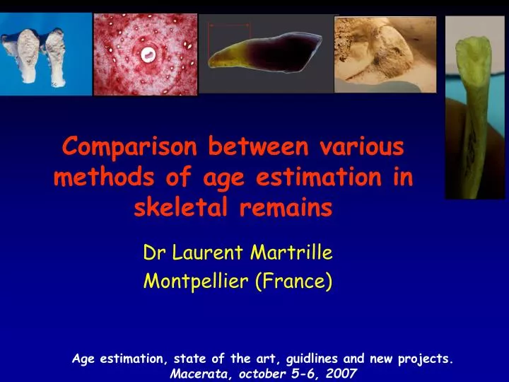 comparison between various methods of age estimation in skeletal remains