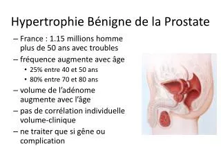 Hypertrophie Bénigne de la Prostate