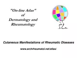 The face in diffuse Systemic Sclerosis: note the radial furrows surrounding the mouth,