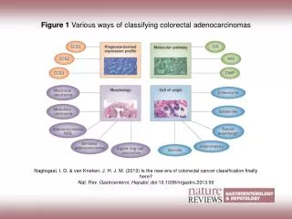 Figure 1 Various ways of classifying colorectal adenocarcinomas