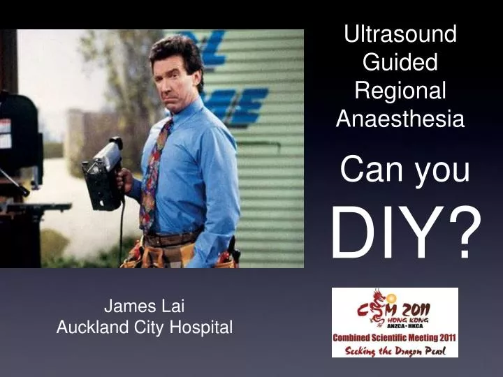 ultrasound guided regional anaesthesia