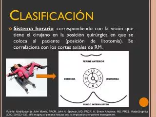 clasificaci n