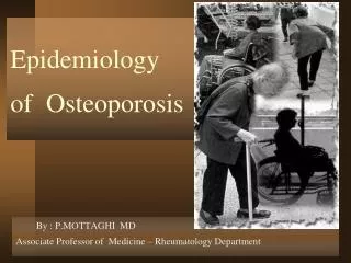Epidemiology of Osteoporosis