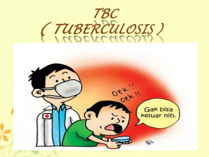 tbc tuberculosis