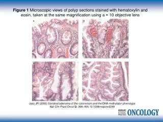 Jass JR (2005) Serrated adenoma of the colorectum and the DNA-methylator phenotype