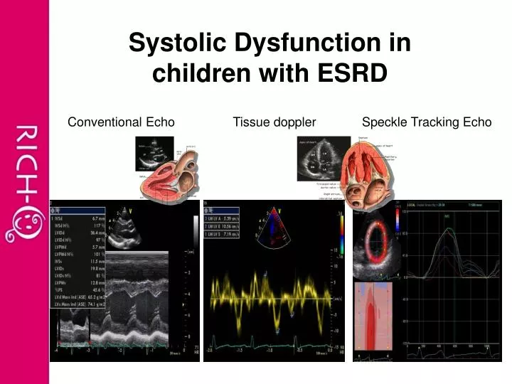 systolic dysfunction in children with esrd