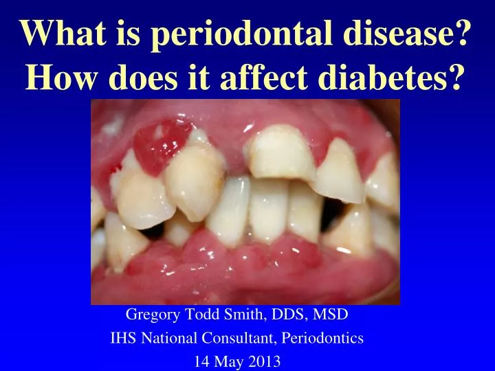 what is periodontal disease how does it affect diabetes