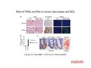 L Zhang et al. Nature 000 , 1-4 (2010) doi:10.1038/nature08871