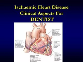 Ischaemic Heart Disease Clinical Aspects For DENTIST