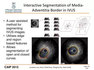 Interactive Segmentation of Media-Adventitia Border in IVUS