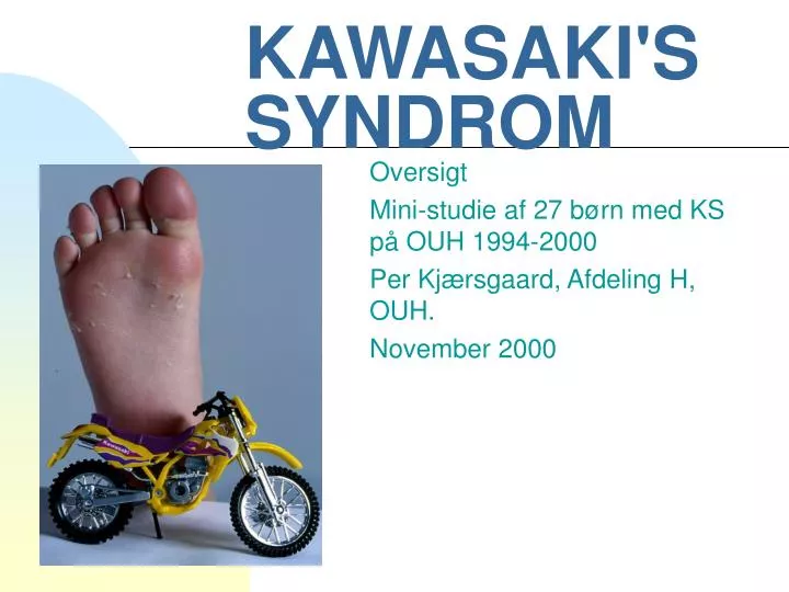 kawasaki s syndrom