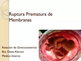 ruptura prematura de membranas