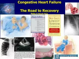 Congestive Heart Failure The Road to Recovery Philip D Houck M.D.