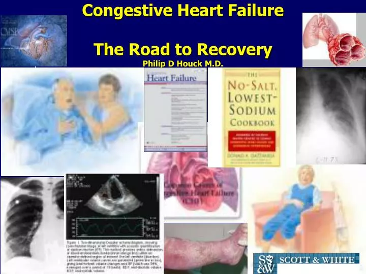 congestive heart failure the road to recovery philip d houck m d