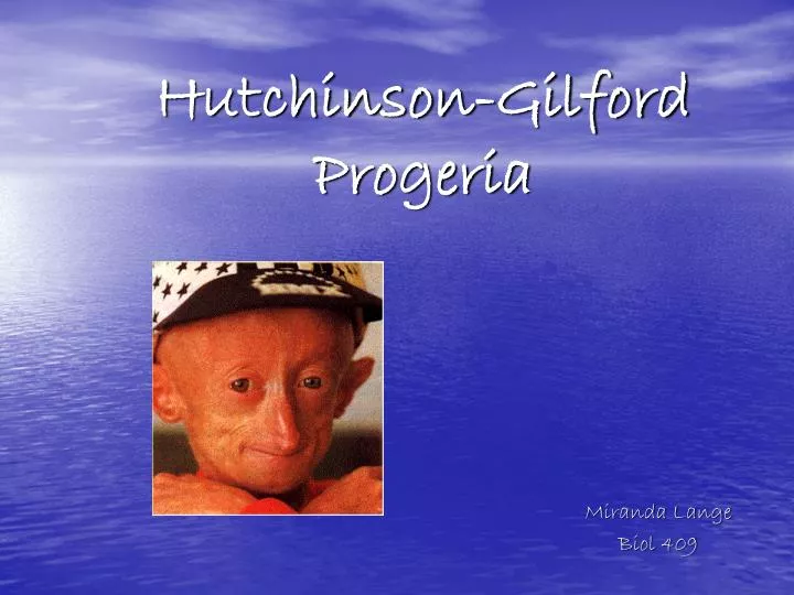 hutchinson gilford progeria