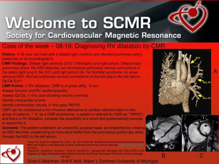 case of the week 08 19 diagnosing rv dilatation by cmr