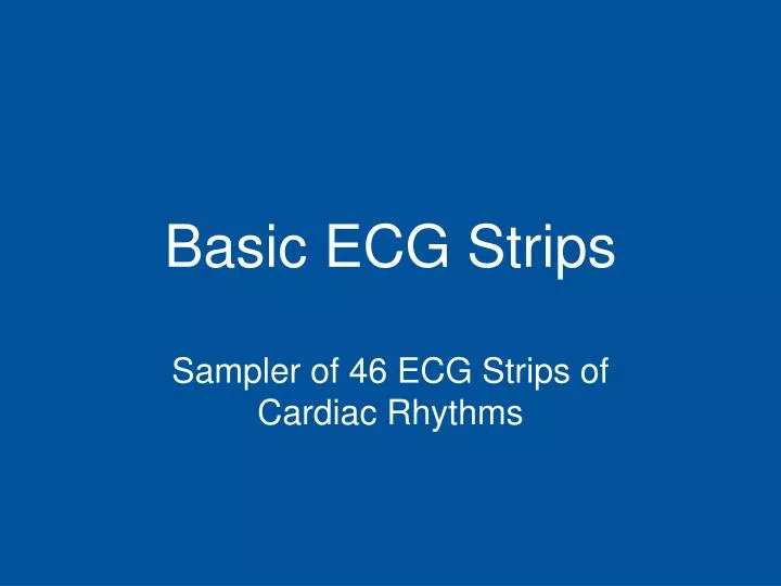 basic ecg strips
